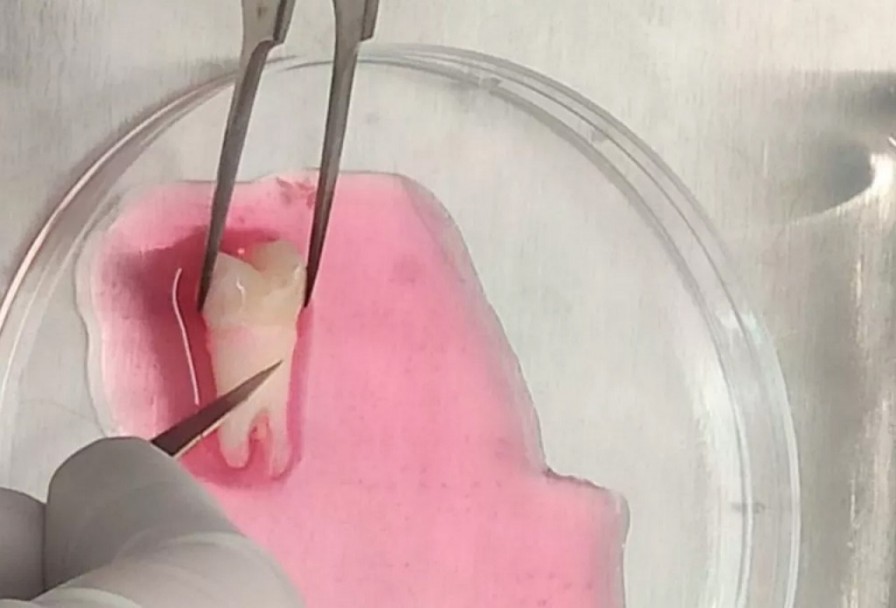 imagen Células madre: una investigación de la UNCUYO avanza en la terapia regenerativa odontológica