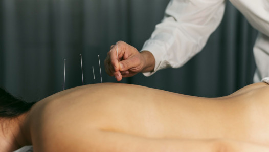 imagen La medicina tradicional china como complemento para la salud