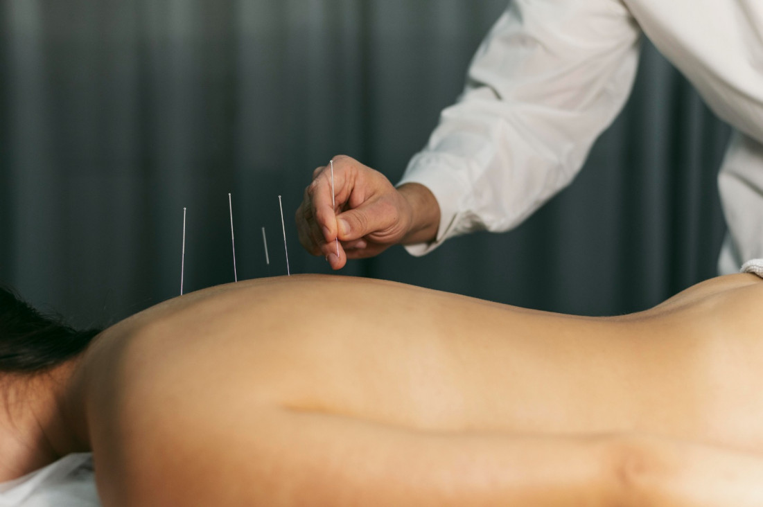 imagen La medicina tradicional china como complemento para la salud