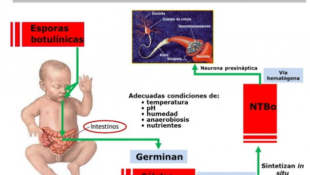 imagen Explican que las bacterias probióticas pueden prevenir el botulismo del lactante