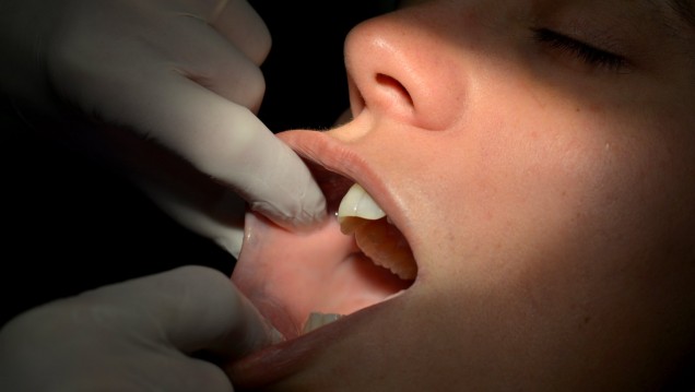 imagen Realizan controles gratuitos para detectar el cáncer bucal