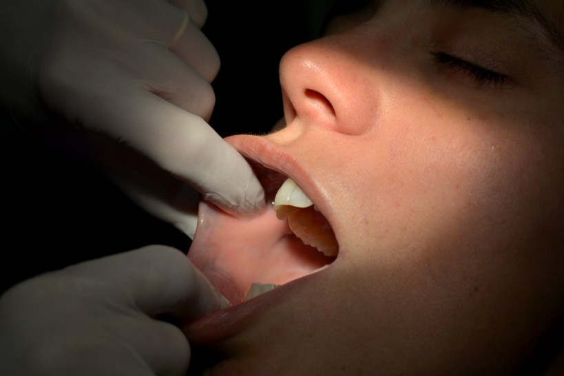 imagen Realizan controles gratuitos para detectar el cáncer bucal