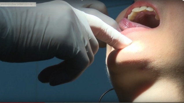 imagen Hacen controles gratuitos para detectar el cáncer bucal