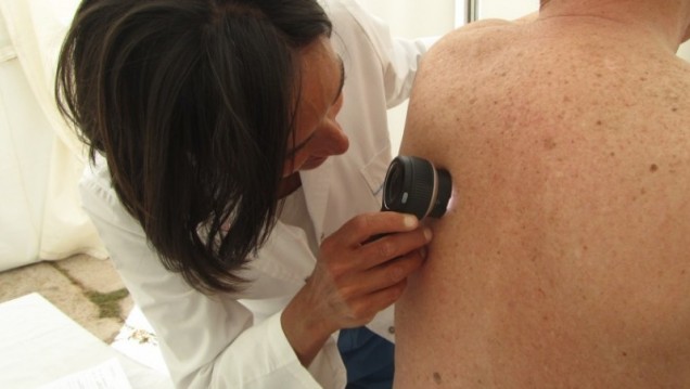 imagen Harán controles gratuitos para prevenir el cáncer de piel