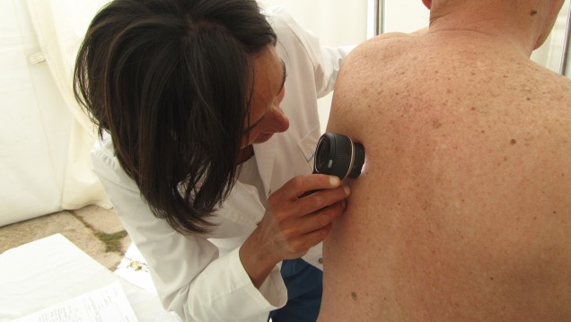 imagen Continúan exámenes para prevenir el cáncer de piel