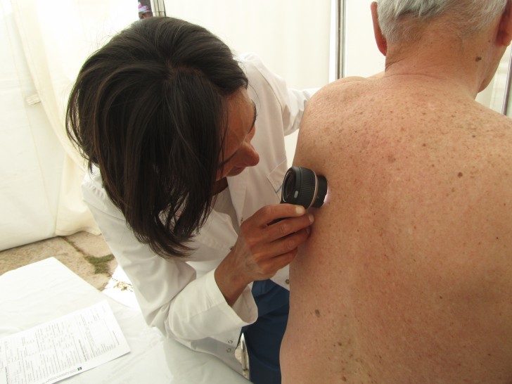 imagen Continúan exámenes para prevenir el cáncer de piel