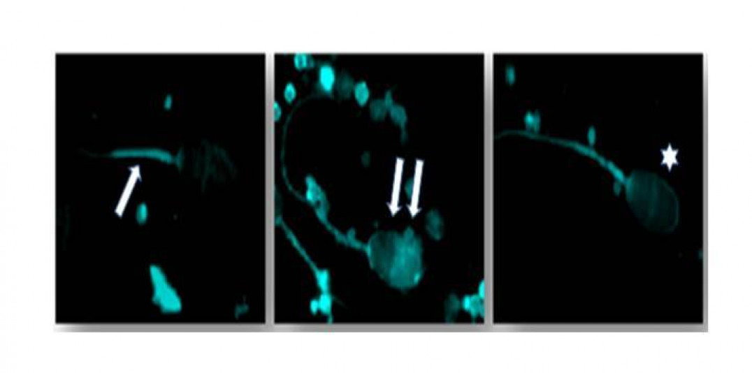imagen Demuestran que las dietas occidentales afectan las características de los espermatozoides 
