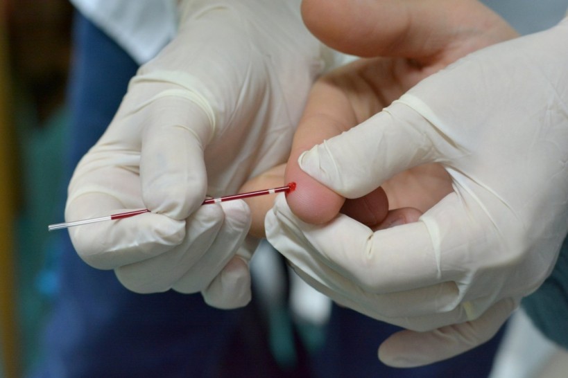 imagen VIH y sífilis: la UNCUYO hará testeos rápidos y gratuitos