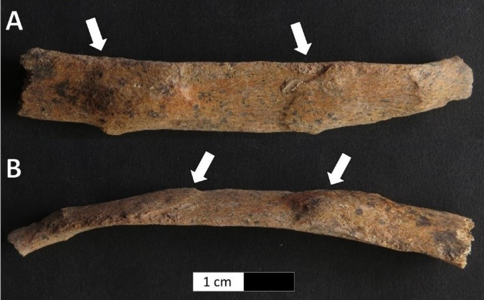 imagen Estudiaron las consecuencias fisiológicas del trabajo en los cuerpos de antiguos habitantes