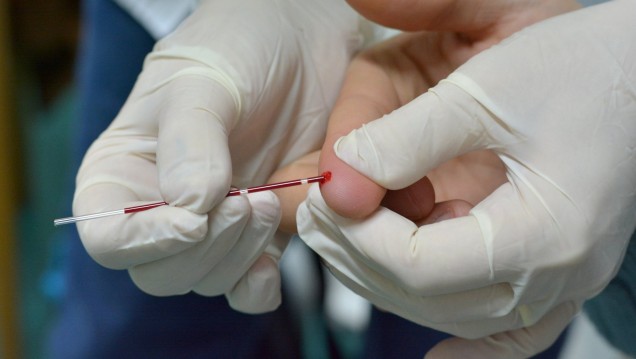imagen Harán test del VIH en el Hospital Universitario