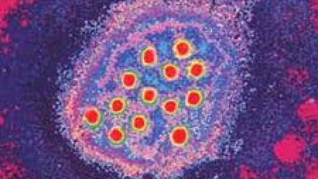 imagen Dio inicio el curso "Prevención de Enfermedades Transmisibles"